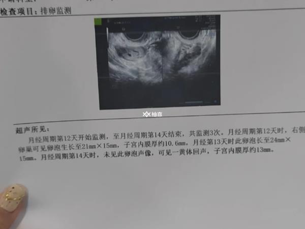 促排取卵后多久可以二次促排