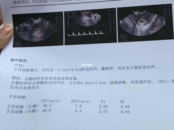 子宫动脉阻力高移植后怎么办