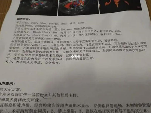 内膜种植窗要检测多久次