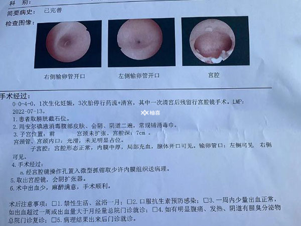 试管移植前有没有必要调内膜