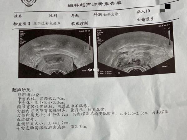 三代试管可不可以避免空囊
