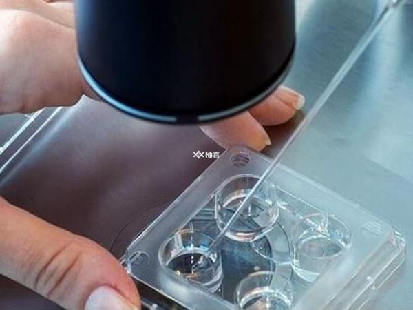 一级胚胎不养囊与什么有关