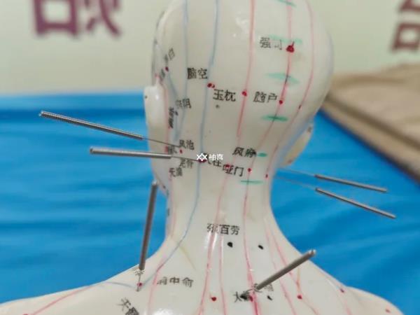 试管促排期间扎针灸有没有用