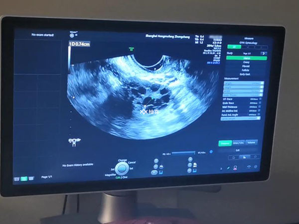 试管只取卵6个成功几率有多大
