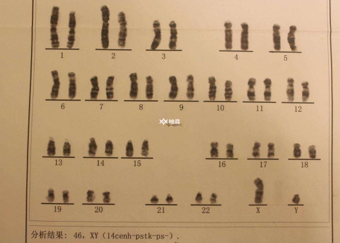 试管婴儿前期检查项目