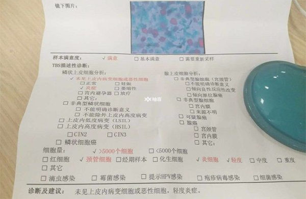 试管前期检查身体会不会不适