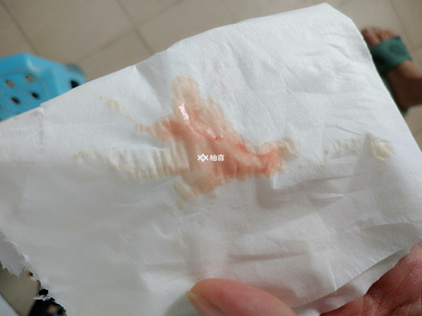 试管生化的原因