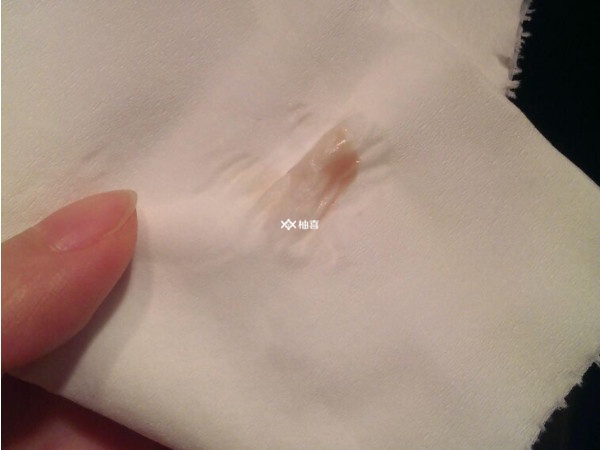 试管移植后焦虑会不会生化