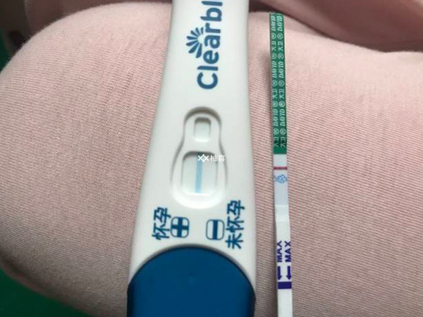 移植后腹痛严重正不正常