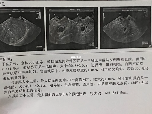 单角子宫怀孕后会不会大出血