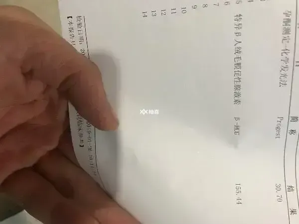 孕期孕酮低会不会呕吐