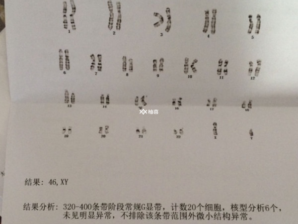 染色体数目变异会不会遗传
