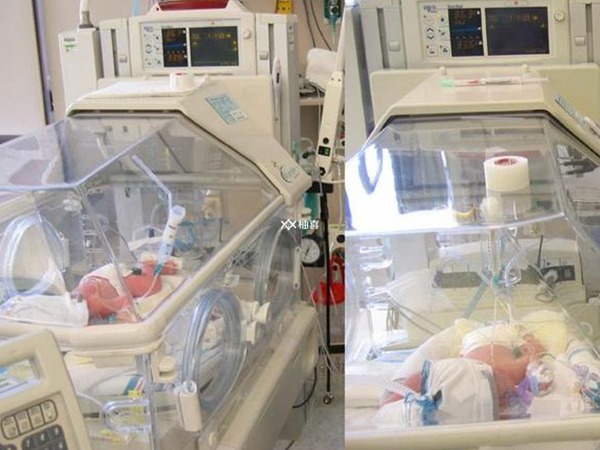 做试管婴儿生双胎会不会大出血