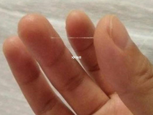 做试管婴儿分泌物拉丝怎么回事