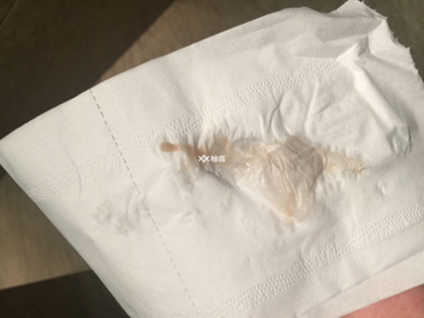 鲜胚移植后出血怎么办