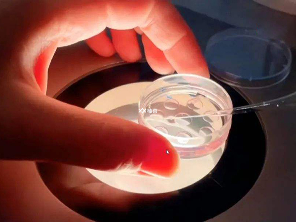 移植两枚鲜胚的用处